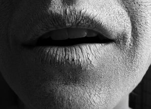 Wrinkles on lips area
